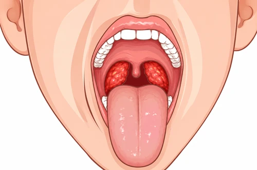 Adenoids