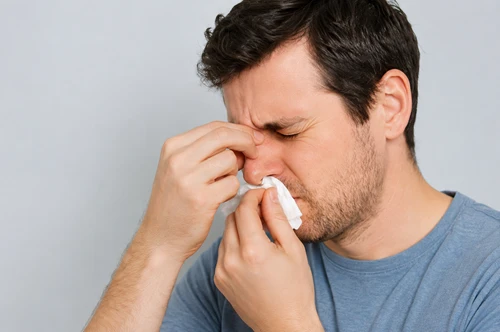 Epistaxis (Nose Bleeding)