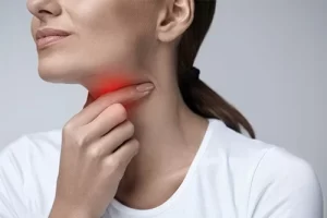 Laryngitis