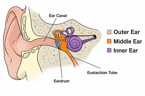 Otitis Media with Effusion (Glue Ear)