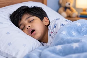 Sleep Apnea in Children