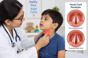 Vocal Cord Palsy in Children